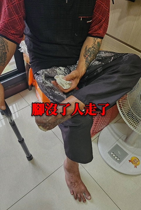 截肢重傷者 × 被拋棄男友