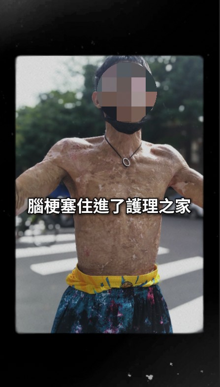 她雙目失明、罹患雙癌，仍努力活下去